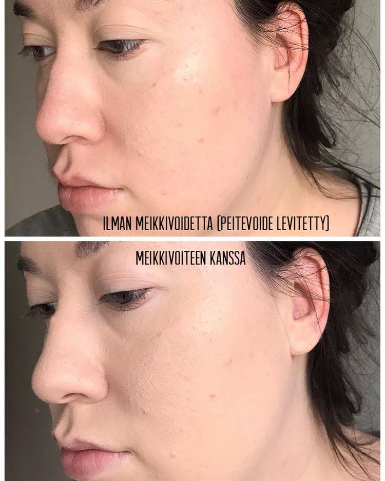 KVD Good Apple Foundation Balm ennen ja jälkeen